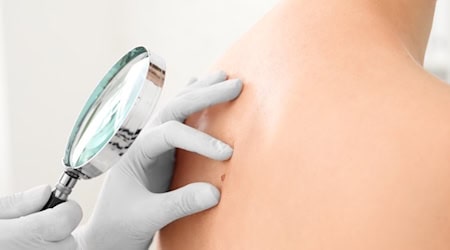 Krebsrate steigt um 87,5 Prozent seit 2003