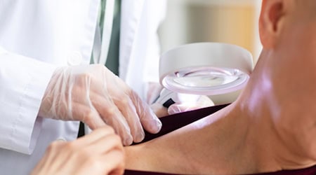Berufsunfähig prüfen bei Diagnose "heller Hautkrebs" 
