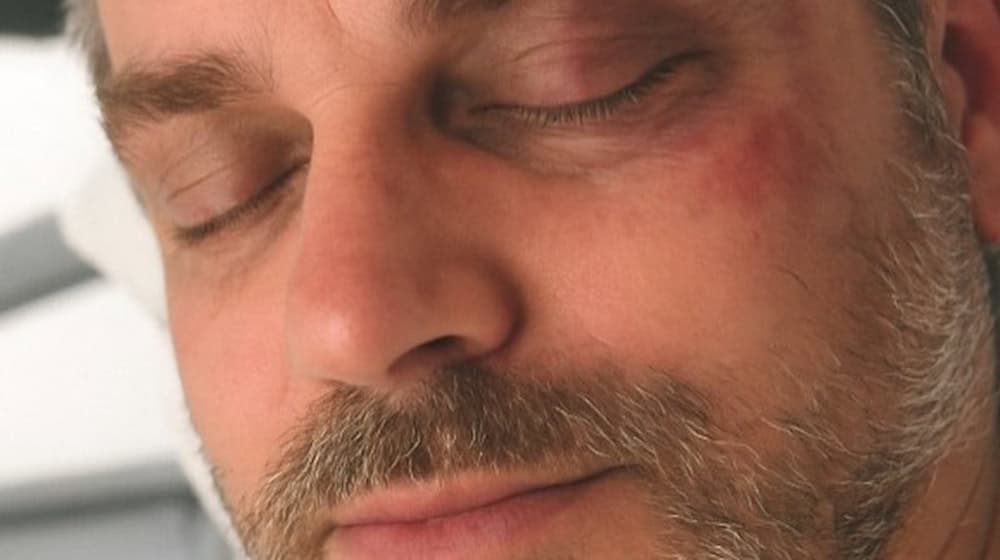 Der Fall lässt die Ermittler nicht los. Am 21. Mai 2023, also vor rund zwei Jahren, wurde Matthias N. (Foto) nach einem anonymen Anruf bei der Feuerwehr schwer verletzt. Foto Polizei