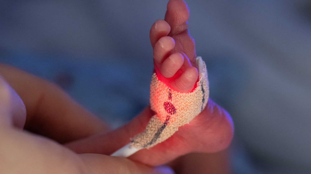 Die wegen zu geringer Fallzahlen mit Schließungsplänen konfrontierte Frühgeborenenstation des Suhler SRH-Klinikums bleibt vorerst erhalten. (Symbolbild) / Foto: Boris Roessler/dpa