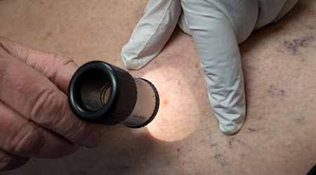 In einer neuen Stiftungspraxis in Elxleben (Kreis Sömmerda) behandeln künftig zwei Dermatologinnen Patienten. (Archivbild) / Foto: Peter Kneffel/dpa