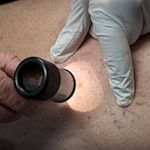 In einer neuen Stiftungspraxis in Elxleben (Kreis Sömmerda) behandeln künftig zwei Dermatologinnen Patienten. (Archivbild) / Foto: Peter Kneffel/dpa