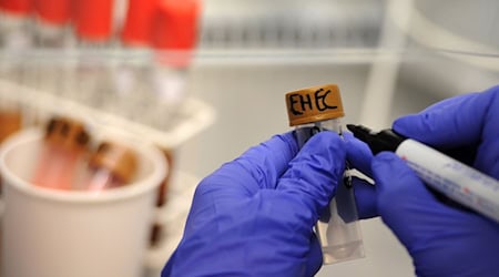 135 Ehec-Fälle bis Ende August – so viele wie nie. Das Gesundheitsamt prüft einen Verdacht in einem Pflegeheim. (Symbolbild)
 / Foto: Christian Charisius/dpa