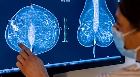 Medizinisches Personal untersucht mit einer Mammografie die Brust einer Frau auf Brustkrebs. / Foto: Hannibal Hanschke/dpa/Archivbild