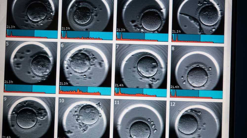 Auf dem Monitor sind Aufnahmen von Embryonen zu sehen. / Foto: Andreas Arnold/dpa