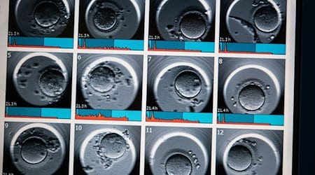 Auf dem Monitor sind Aufnahmen von Embryonen zu sehen. / Foto: Andreas Arnold/dpa