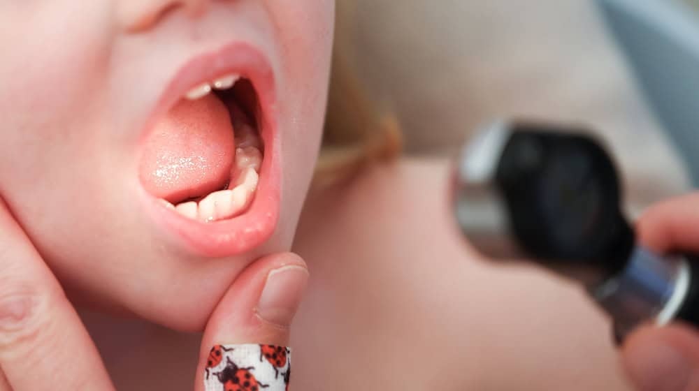 Viermal mehr Kinder mit Scharlach sind 2023 in niedersächsischen Arztpraxen behandelt worden - im Vergleich zum Vorjahr. (Symbolbild) / Foto: Christian Charisius/dpa