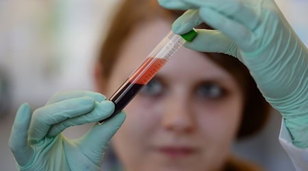 Der Anteil der schwangeren Frauen, die einen vorgeburtlichen Bluttest auf Trisomien vornehmen lassen, steigt nach Daten der Krankenkasse Barmer in Niedersachsen. (Symbolbild) / Foto: Patrick Seeger/dpa