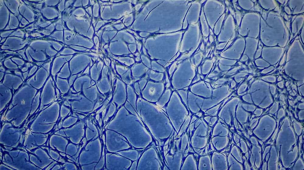 Proben kultivierter Fischzellen sind auf einem Monitor eines Mikroskops zu sehen. (Archivbild) / Foto: Axel Heimken/dpa