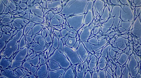 Proben kultivierter Fischzellen sind auf einem Monitor eines Mikroskops zu sehen. (Archivbild) / Foto: Axel Heimken/dpa