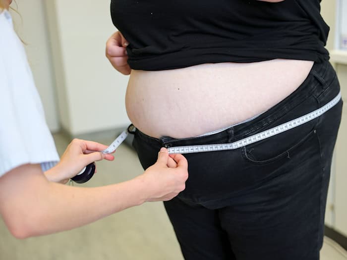 Laut AOK haben elf Prozent der Bevölkerung in Niedersachsen eine Adipositas-Diagnose. (Symbolbild) / Foto: Jan Woitas/dpa
