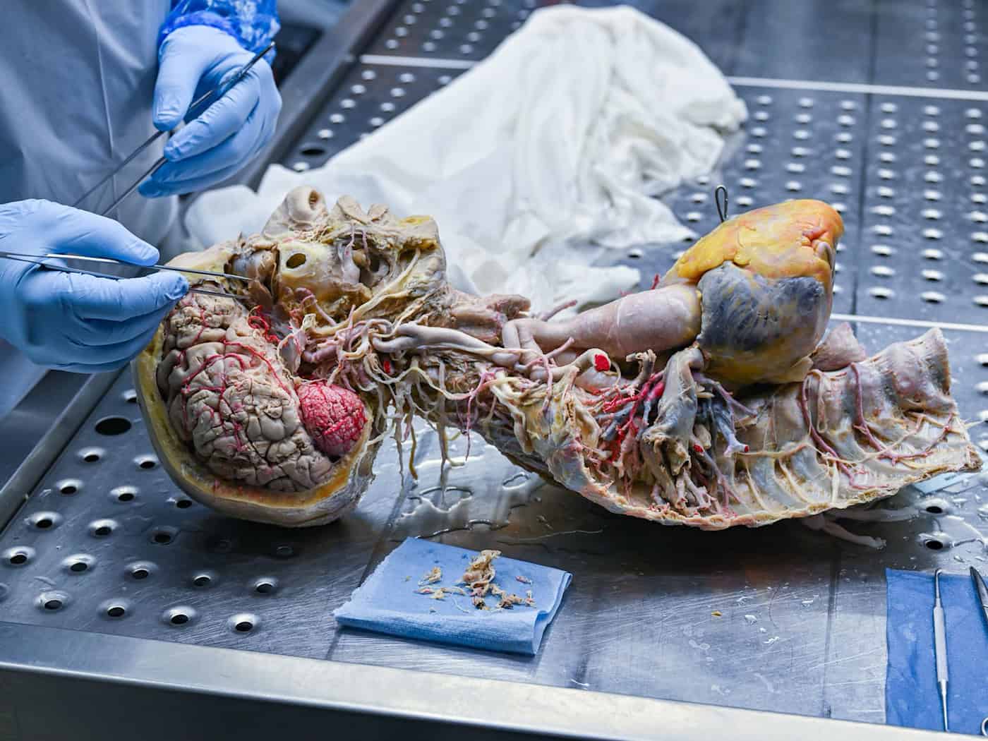 Guben: Plastinarium übergibt plastiniertes Herz an Transplantierte aus Wunstorf