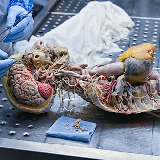 In der Werkstatt im brandenburgischen Guben entstehen die Plastinate der Organe. (Archivbild) / Foto: Patrick Pleul/dpa