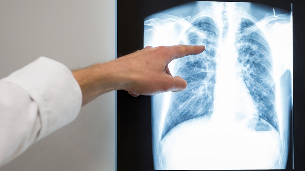 Ein Arzt zeigt auf das Röntgenbild einer Lunge. / Foto: Silas Stein/dpa/Symbolbild
