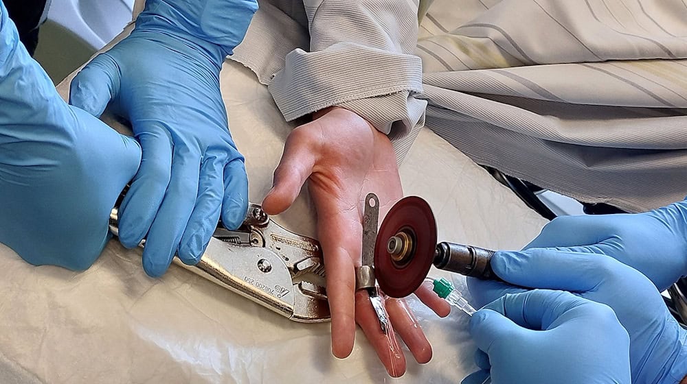 Die Feuerwehr entfernt eine Schraubenmutter vom Finger eines Jugendlichen.  / Foto: -/Berufsfeuerwehr München/dpa
