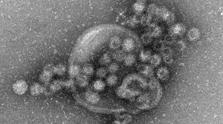 Das Norovirus ist sehr leicht übertragbar und gehört zu den weltweit häufigsten Erregern für plötzlich auftretenden Brechdurchfall.  / Foto: Gudrun Holland/RKI/Robert-Koch-Institut/dpa