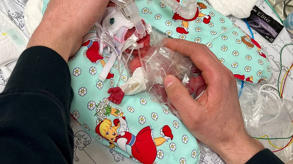Etwas mehr als ein Päckchen Butter wog die kleine Marie, als sie im Februar zur Welt kam. Seitdem ist das Kind gut gewachsen. / Foto: Privat/Kinderklinik Dritter Orden Passau/dpa