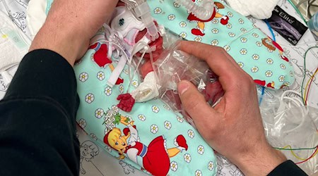 Etwas mehr als ein Päckchen Butter wog die kleine Marie, als sie im Februar zur Welt kam. Seitdem ist das Kind gut gewachsen. / Foto: Privat/Kinderklinik Dritter Orden Passau/dpa