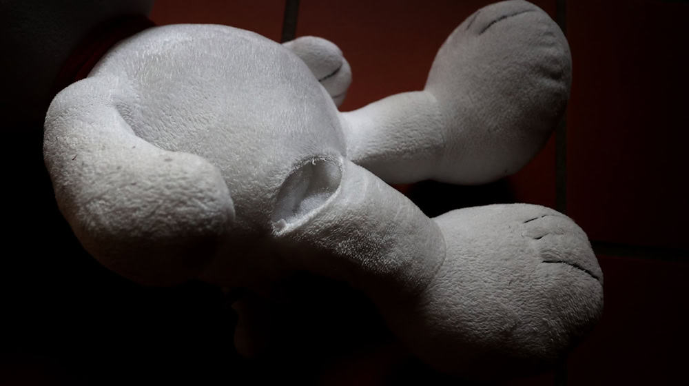 Ob das Kind bleibende Schäden hat, ist noch ungewiss. (Symbolbild) / Foto: Karl-Josef Hildenbrand/dpa