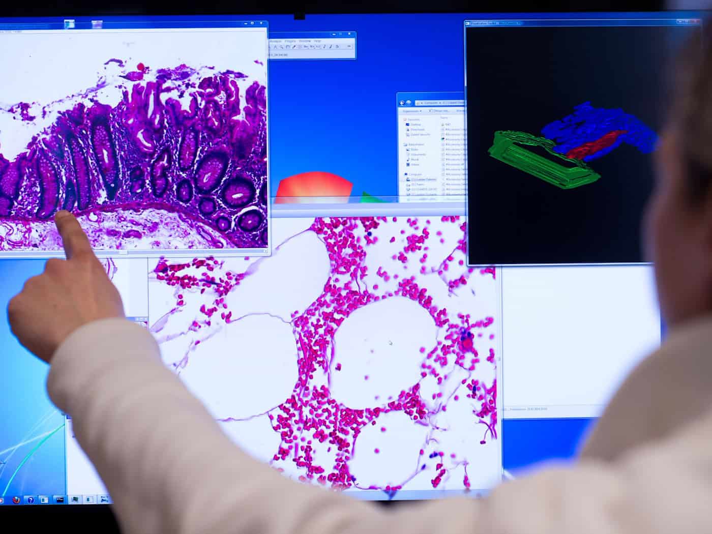 Die Diagnostik hat sich seit Jahren verbessert - nicht nur bei der Behandlung von Darmkrebs, auch bei der Früherkennung. (Illustration)  / Foto: Bernd von Jutrczenka/dpa