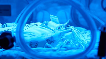 Zwei Jahre wird das Projekt in Nürnberg getestet, dann könnte die KI bayernweit eingesetzt werden. (Symbolbild) / Foto: Bernd Thissen/dpa