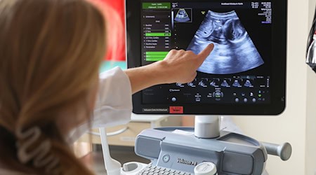 Auf dem Ultraschallbild ist laut der Ärztin zu sehen, dass Jasmin Schmidt wieder Zwillingsmädchen bekommt. / Foto: Daniel Löb/dpa