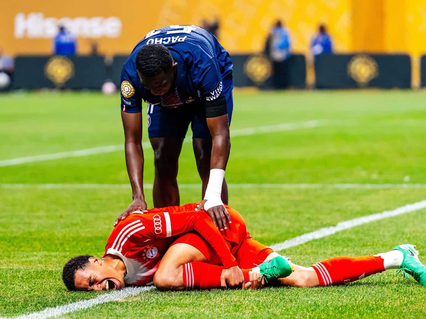 Der Schockmoment: Jamal Musiala greift sich bei der Club-WM mit Schmerzen ans verletzte linke Bein. (Archivbild) / Foto: Malachi Gabriel/ZUMA Press Wire/dpa