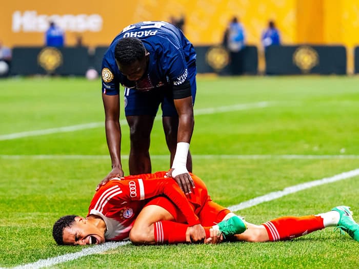 Der Schockmoment: Jamal Musiala greift sich bei der Club-WM mit Schmerzen ans verletzte linke Bein. (Archivbild) / Foto: Malachi Gabriel/ZUMA Press Wire/dpa