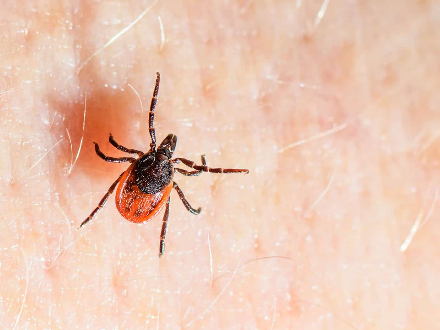 Der Gemeine Holzbock ist die häufigste Zeckenart in Deutschland und auch die, die hauptsächlich FSME und Borreliose auf den Menschen übertragt. (Archivbild) / Foto: Patrick Pleul/dpa