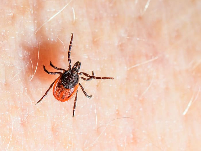 Der Gemeine Holzbock ist die häufigste Zeckenart in Deutschland und auch die, die hauptsächlich FSME und Borreliose auf den Menschen übertragt. (Archivbild) / Foto: Patrick Pleul/dpa