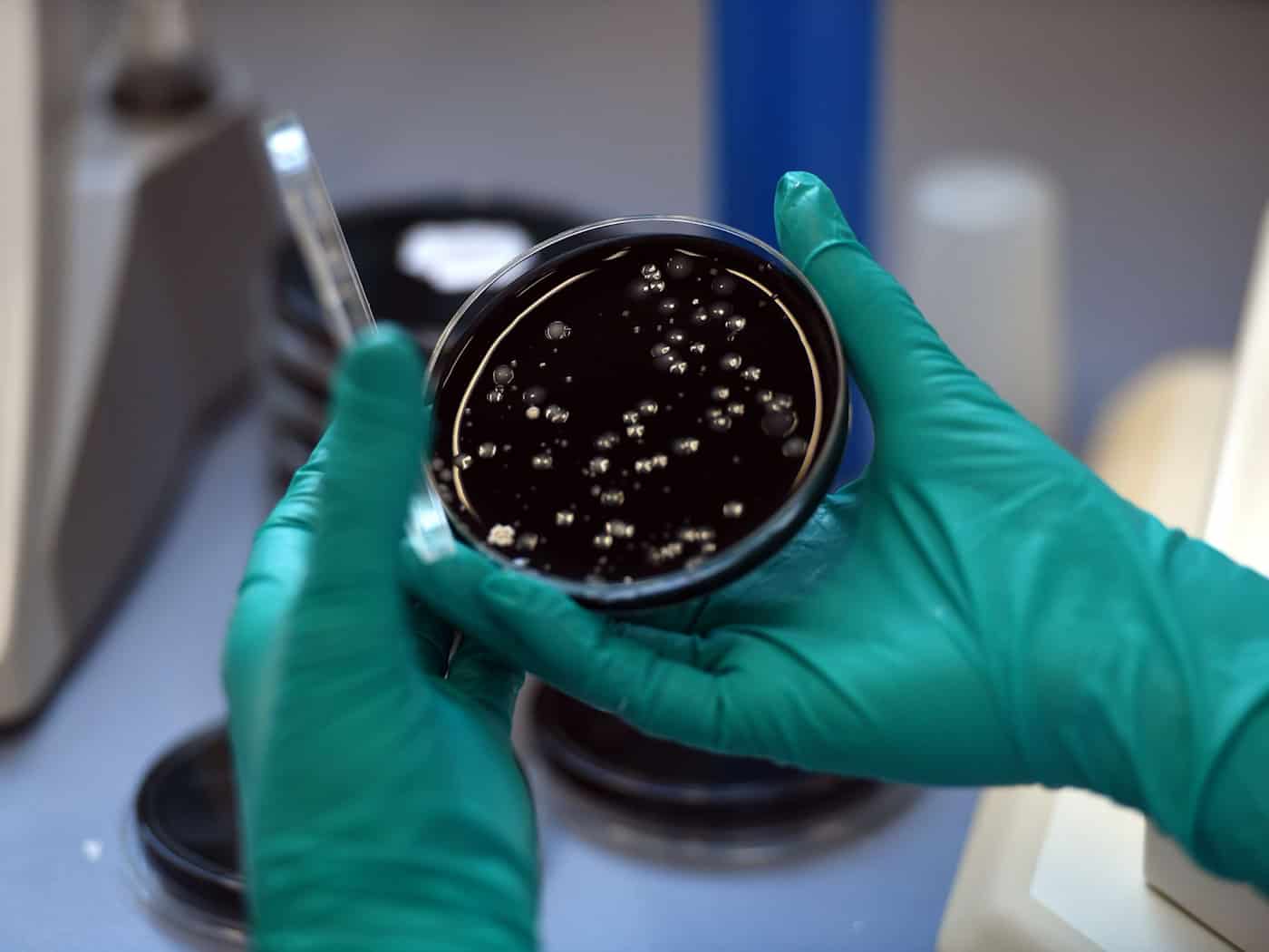 Nach einem Legionellen-Ausbruch in Ulm sind zwei Menschen gestorben. (Symbolbild)  / Foto: picture alliance / dpa
