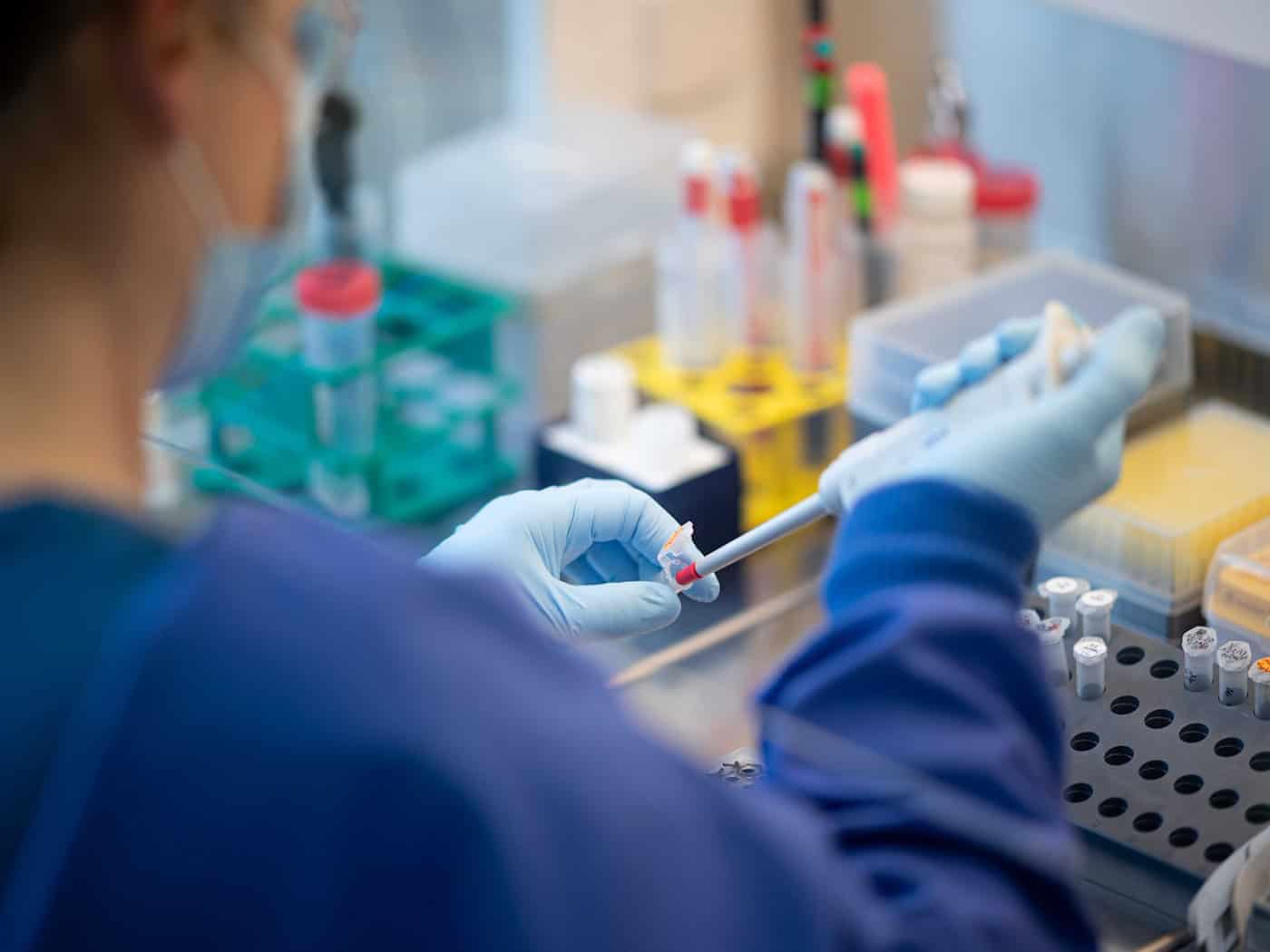 Im BZI werden aktuelle Erreger nahezu in Echtzeit beobachtet. (Symbolbild) / Foto: Daniel Reinhardt/dpa
