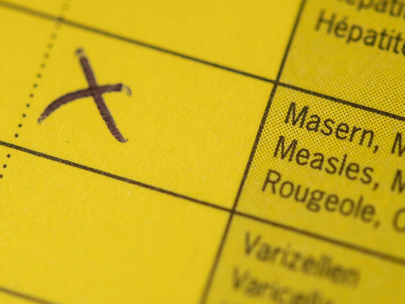 Masernfälle in Bayern stark gesunken – Gerlach mahnt zu vollständigem Impfschutz