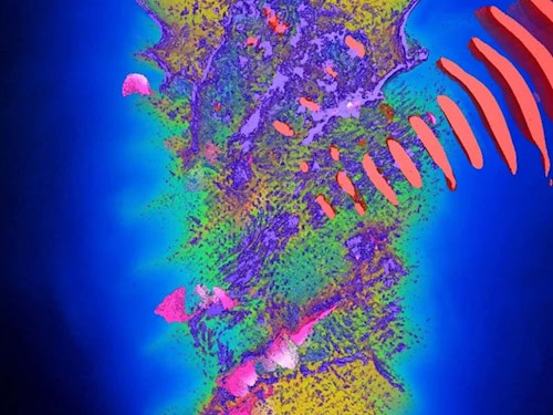 So könnte künftig Krebs behandelt werden. Die Simulation zeigt, wie ein Laser Protonen auf hohe Energien beschleunigt. Auf dem Supercomputer Discovery soll das berechnet werden.