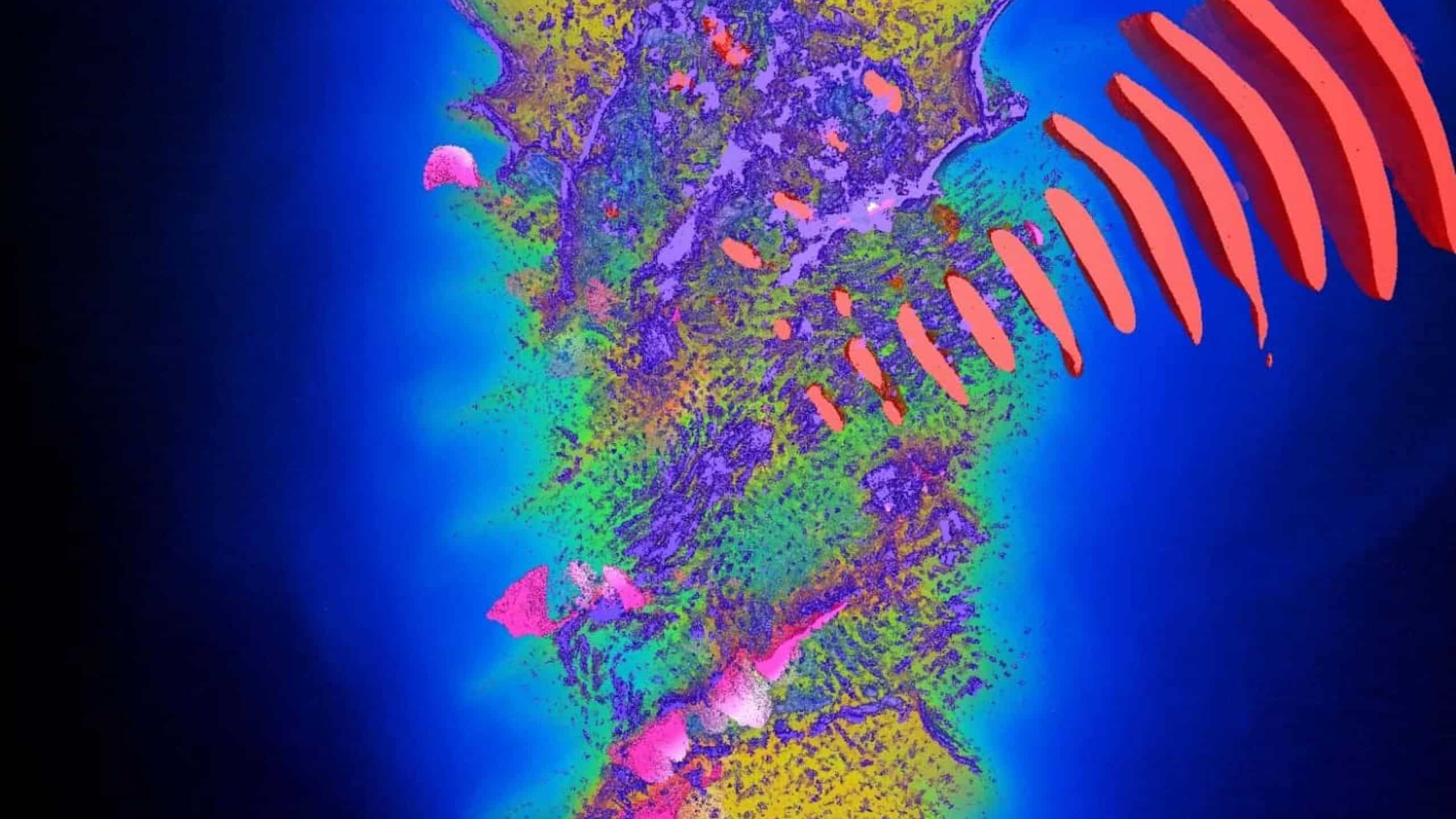 So könnte künftig Krebs behandelt werden. Die Simulation zeigt, wie ein Laser Protonen auf hohe Energien beschleunigt. Auf dem Supercomputer Discovery soll das berechnet werden.