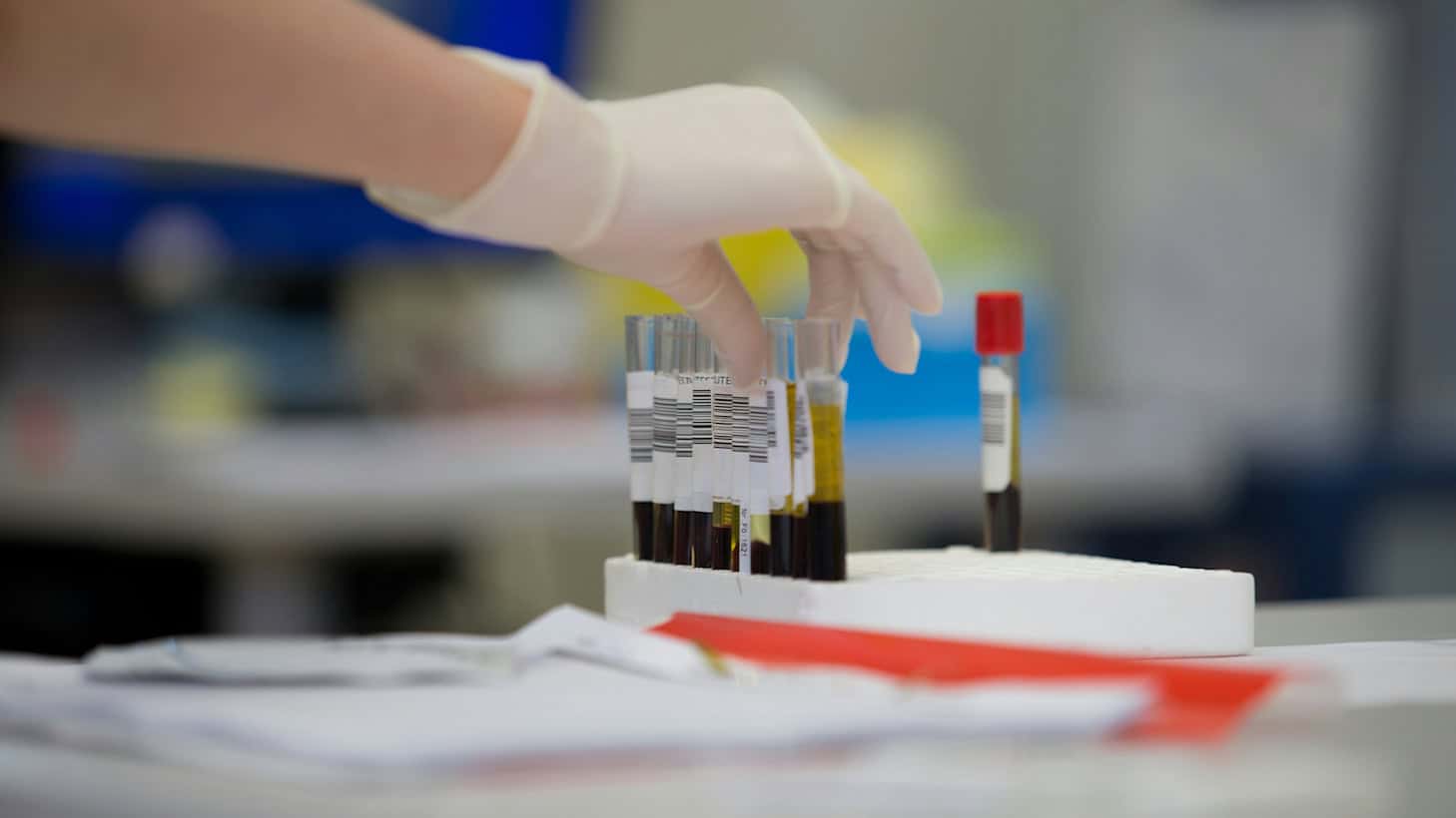 Blood samples in a medical laboratory