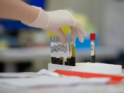 Blood samples in a medical laboratory
