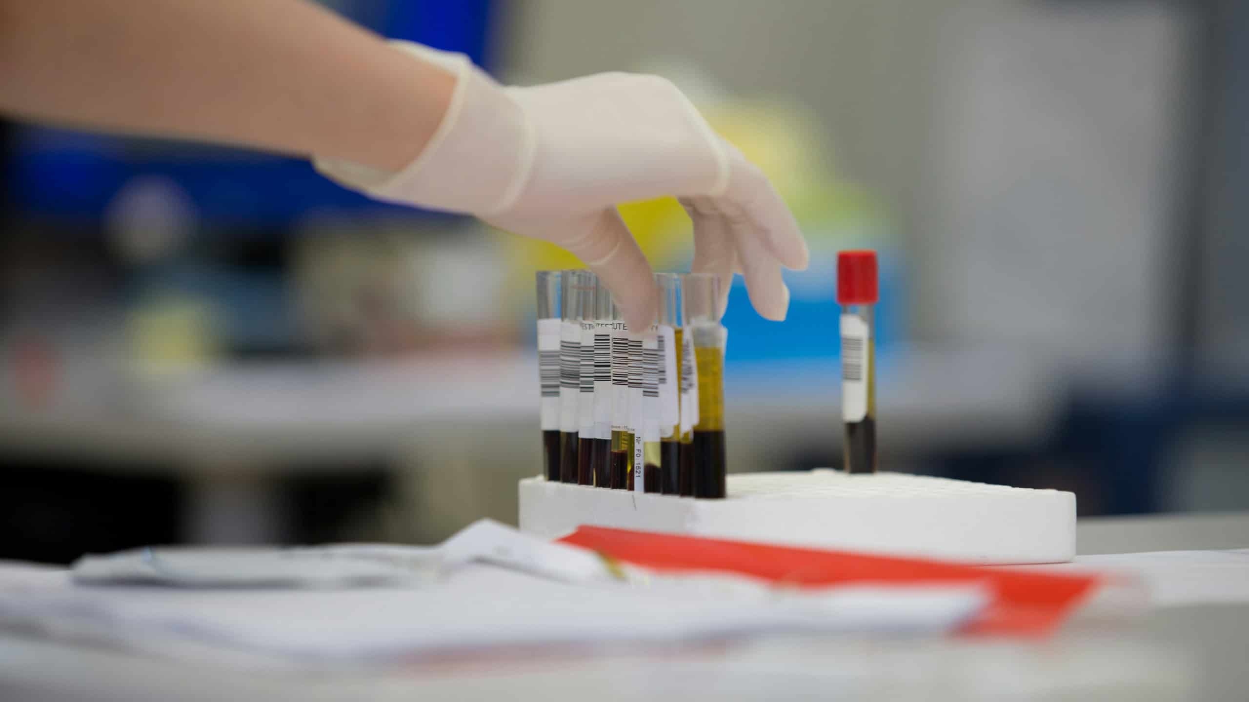 Blood samples in a medical laboratory