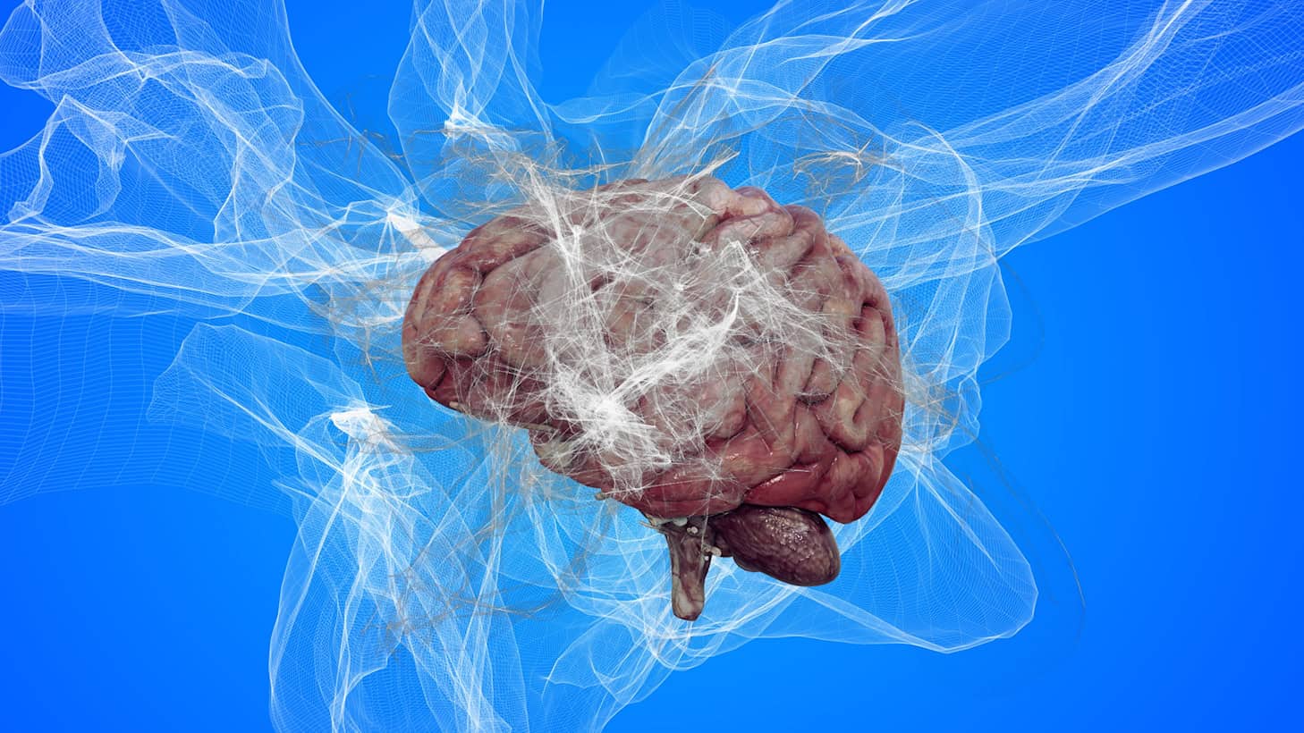 Illustration of a human brain surrounded by fog, symbolizing dementia and memory problems.