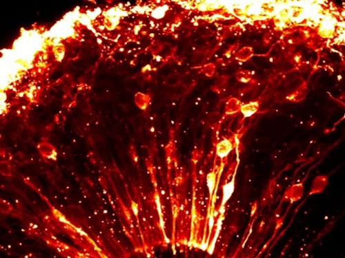 Mikroskopische Aufnahme eines menschlichen Gehirn-Organoids mit leuchtend eingefärbten Zellen und Verzweigungen.