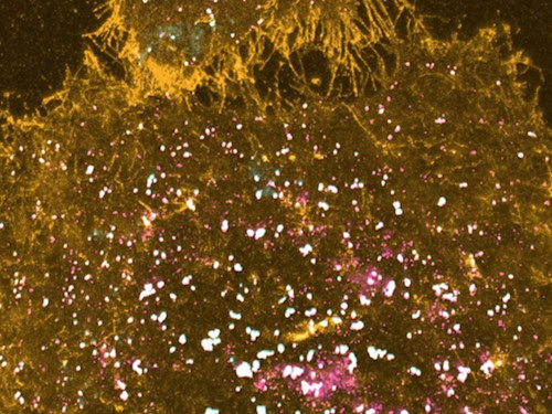 Mikroskopieaufnahme der Membran einer menschlichen Melanomzelle mit orange dargestellten Lipiden