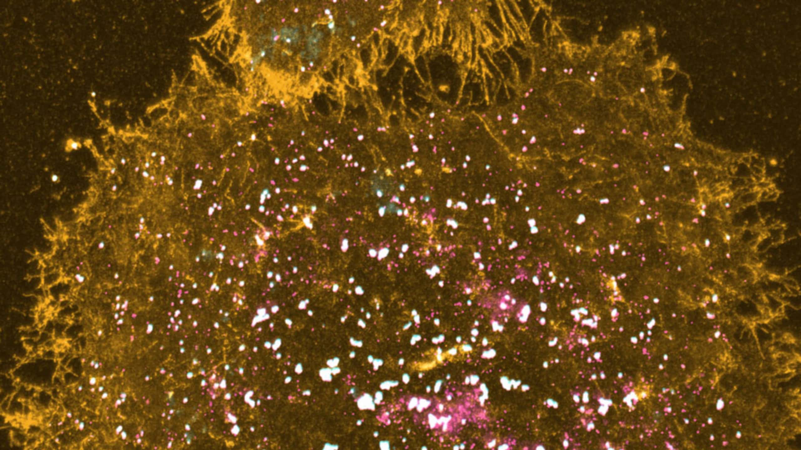 Mikroskopieaufnahme der Membran einer menschlichen Melanomzelle mit orange dargestellten Lipiden