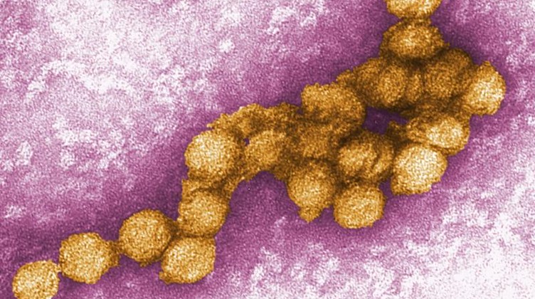 Das West-Nil-Virus unter dem Elektronenmikroskop. Foto: Cynthia Goldsmith/CENTERS FOR DISEASE CONTROL/EPA/dpa/Archivbild