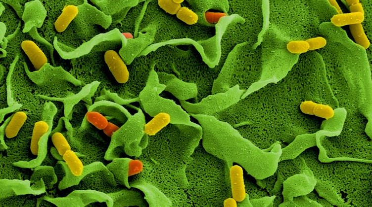 Elektronenmikroskopische Aufnahmen von Listerien (Listeria monocytogenes). Foto: Manfred Rohde/Helmholtz-Zentrum für Infektionsforschung/dpa