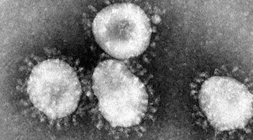 Ein Coronavirus unter dem Mikroskop. Foto: Center for Disease Control/epa/dpa/Archivbild