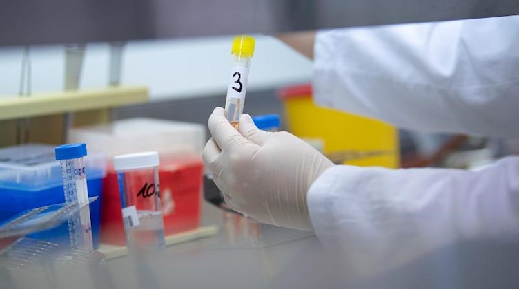 Eine Ärztin zeigt in einem Labor einen Test für das Coronavirus. Foto: Sebastian Gollnow/dpa/Symbolbild