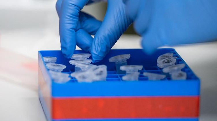 Eine Laborantin führt Untersuchungen zum Coronavirus durch. Foto: Christophe Gateau/dpa/Symbolbild