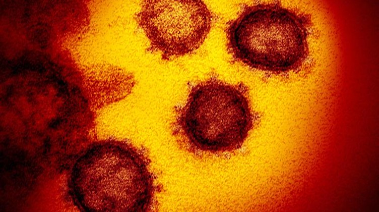 Eine undatierte elektronenmikroskopische Aufnahme des Coronavirus (SARS-CoV-2). Foto: NIAID-RML/AP/dpa/Archivbildd