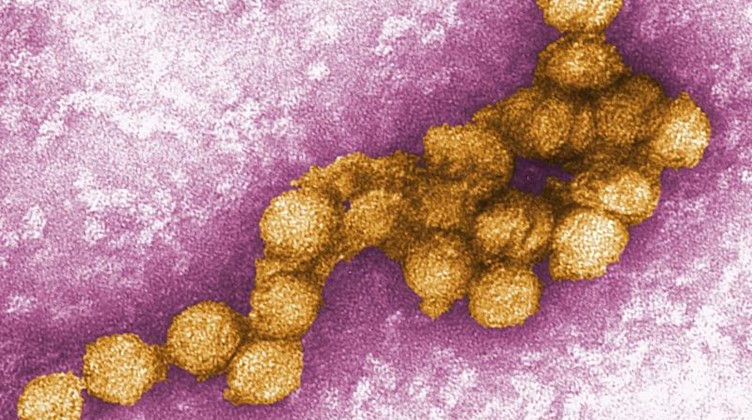 Das West-Nil-Virus unter dem Elektronenmikroskop. Foto: Cynthia Goldsmith/CENTERS FOR DISEASE CONTROL/EPA/dpa/Archivbild