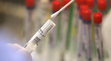 Ein Abstrich wird in einem Labor auf das Coronavirus untersucht. Foto: Oliver Berg/dpa/Symbolbild